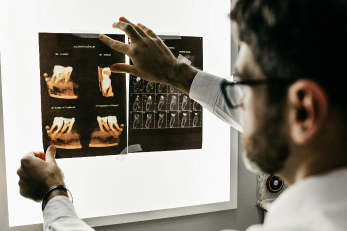 Dentist looking at teeth X-rays
