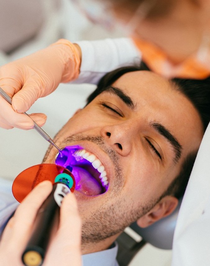 Composite Bonding